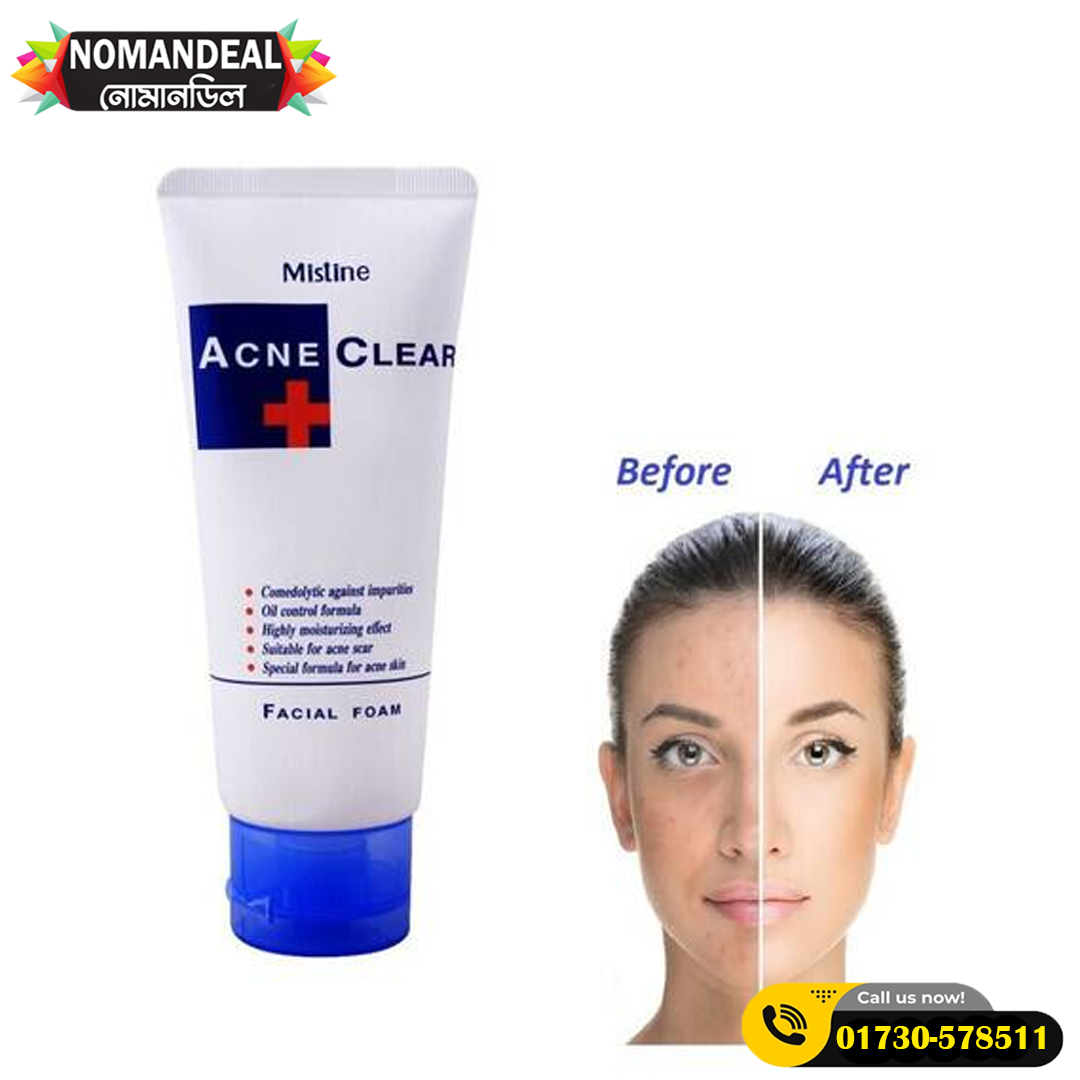 MISTINE ACNE CLEAR FACIAL FOAM 85G. Face wash (Made In Thailand)